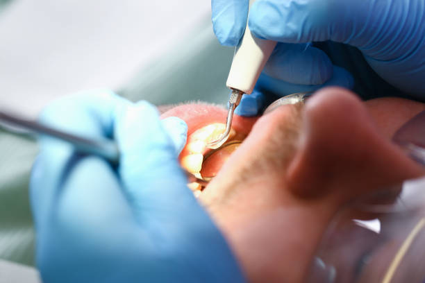 Best Emergency Gum Treatment in Mccom, OH