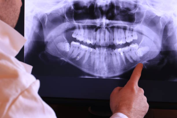 Best Emergency Dental Care for Broken or Chipped Teeth in Mccom, OH