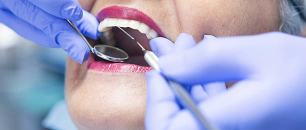 Best Emergency Denture Repair in Mccom, OH